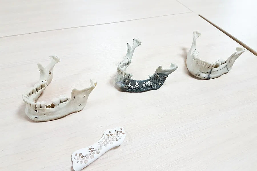 3D-принтер SLM